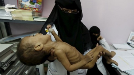  85000 Kinder im Jemen seit saudischer Invasion gestorben