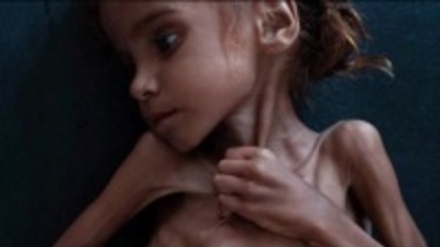   Саъудия Арабистони Яманни дўзахга айлантирган жиноятлари 30 сонияда(Видео)