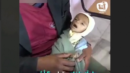 イエメンで、惨状が継続、乳児を助け出そう父親の苦痛な努力（動画）