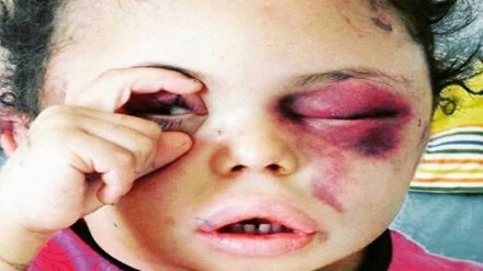 「人類の瞳」のイエメン人少女が、サウジでの１年間の拘束後に釈放