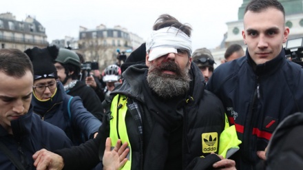 Acte 11 : une figure des Gilets jaunes grièvement blessée à l'œil 