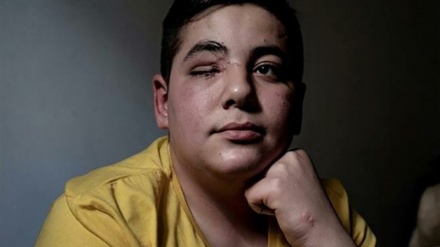 Gilets jaunes: un Syrien victime de la police