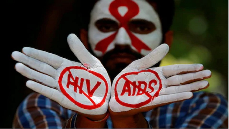 اگر این نشانه ها را دارید احتمالا مبتلا به ایدز(HIV) هستید