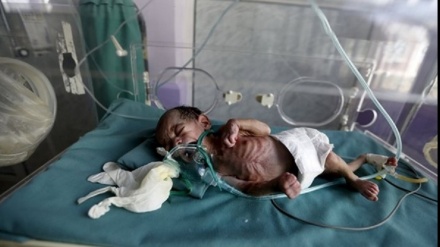 イエメン保健省が、同国での人道状況に関して警告