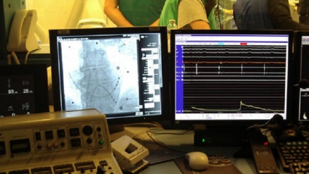 L'aritmia più comune potrebbe aumentare rischio di demenza