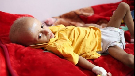 イエメン保健省、「イエメンで１０分ごとに一人の子どもが死亡」