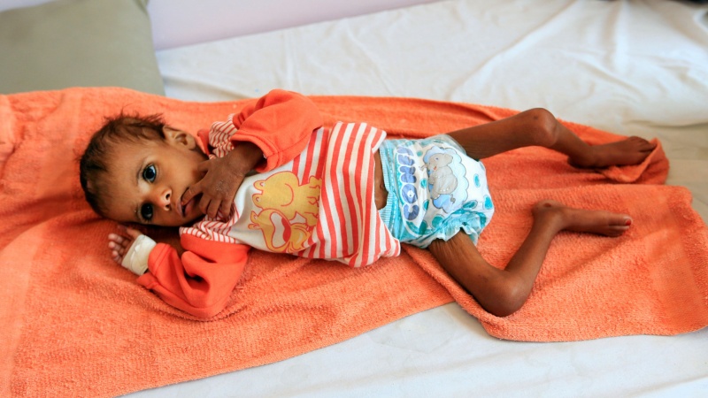  سازمان ملل: نیم میلیون یمنی به وبا مبتلا شدند