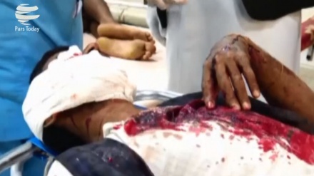 Begini Kondisi Korban Serangan Udara Terbaru Saudi ke Yaman