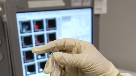 Si trova nell'intestino l'origine del fegato grasso