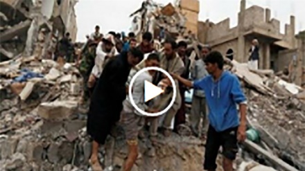 تصاویر دلخراش از جنایت سعودی‌ها در یمن