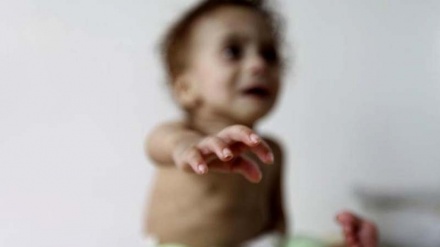 ユニセフが警鐘、「世界で数百万人の子どもが栄養不良」