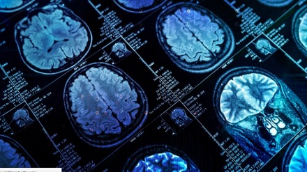 Artificial intelligence improves biomedical imaging