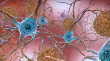 Isolato nel Dna di una donna il gene anti Alzheimer
