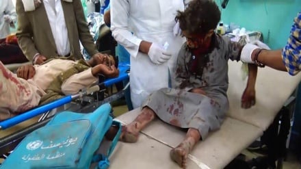 Në Jemen janë vrarë me mijëra gra dhe fëmijë që nga fillimi i agresionit ushtarak saudit