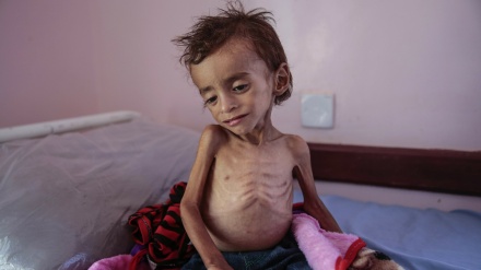UNICEF: Mamilioni ya watoto wa Yemen katika hatari ya kufa njaa