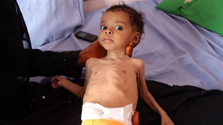‘This is hell!’ UN issues solemn warning about Yemen