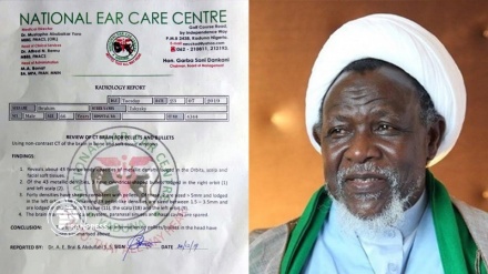 Ripoti ya X-Ray: Kuna vipande 43 vya mabaki ya risasi kwenye mwili wa Zakzaky