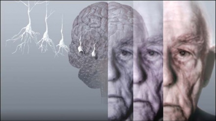 ضربان / اختلال حافظه ، زوال عقل یا آلزایمر 