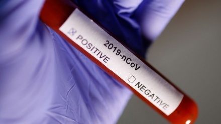 中国の研究者らが、「センゼンコウ」を新型コロナウイルス媒介者と推定