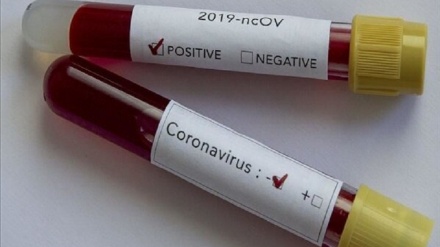 伊朗驻莫斯科大使：俄罗斯向伊朗捐赠5万个新冠病毒检测试剂