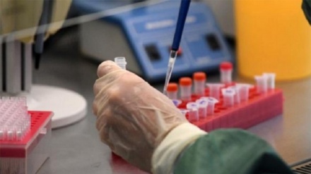 Россияда коронавирус инфекциясини аниқловчи тест яратилди