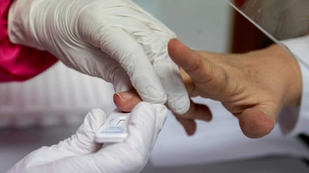 Sanidad anuncia que ya se hacen entre 40.000 y 47.000 test diarios 