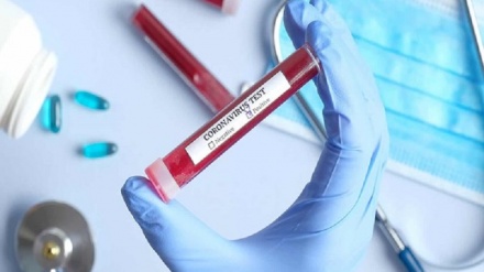 איראן מייצרת את הציוד לאיבחון וירוס הקורונה