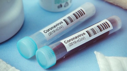 Gesundheitsministerium des Iran: Kauf von Corona-Diagnosekits über SWIFT wird unter dem Vorwand von Sanktionen storniert