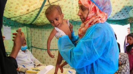 Unicef: Idadi ya watoto wanaosumbuliwa na utapiamlo imeongeza sana Yemen