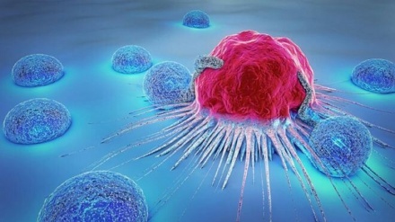نشانه‌های موذی‌ترین سرطان در بدن