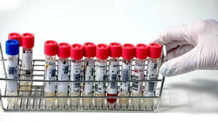 Hari ini, 102.991 Pasien COVID-19 di Indonesia Sembuh