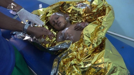  هشدار سازمان ملل درباره مرگ بیش از یک میلیون یمنی