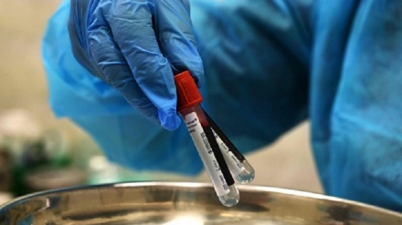 Covid, Oms: Italia record di nuovi casi in Europa