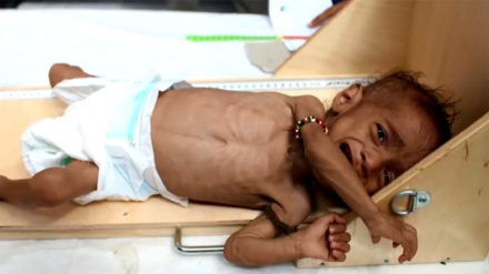 UN: Bila msaada wa haraka wa fedha, maelfu ya watoto wanaweza kufariki dunia Yemen