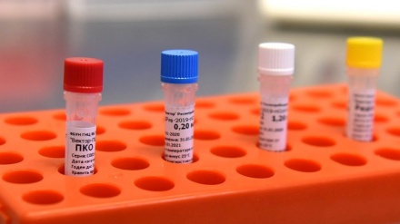 Կորոնավիրուսի 392 նոր դեպք, առողջացել է 135 մարդ, մահացել 2-ը