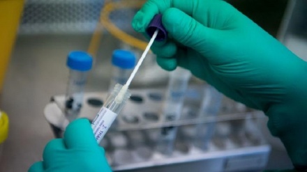 Կորոնավիրուսի 429 նոր դեպք, առողջացել է 175 մարդ, մահացել 1-ը