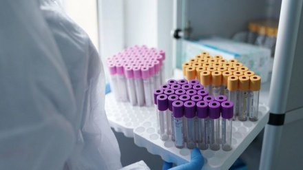 Ўзбекистонда  коронавирус билан касалланганларнинг умумий сони 58 421 нафарга етди