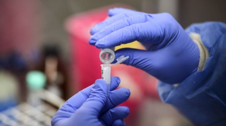 Ўзбекистонда бир суткада 465 кишида коронавирус қайд этилди 