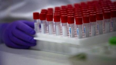 Ўзбекистонда касалланиш ҳолатлари сони 57 мингдан ошди