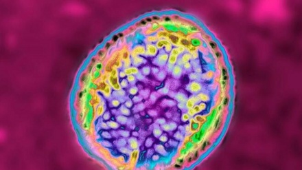 中国で6000人がブルセラ症に