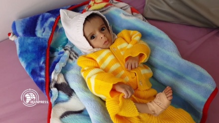 Niños yemeníes, principales víctimas de la guerra