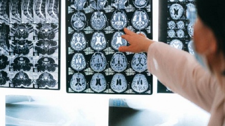 Why are some scientists turning away from brain scans?