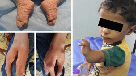 伊拉克向国际法院起诉美国使用含铀武器