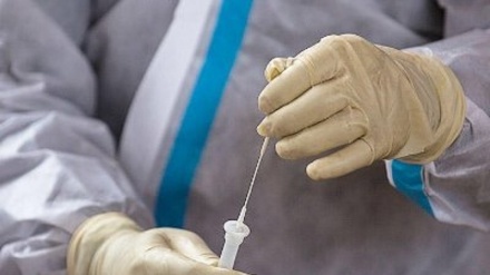 Հայաստանում հաստատվել է կորոնավիրուսով վարակվելու 396 նոր դեպք. մահացել է 16 մարդ