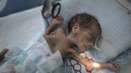 At a Yemen hospital wracked by US funding cuts, children dying of hunger