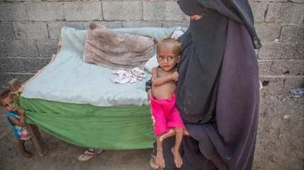 مرگ روزانه  ۸۰ نوزاد یمنی در محاصره ظالمانه سعودی‌ها