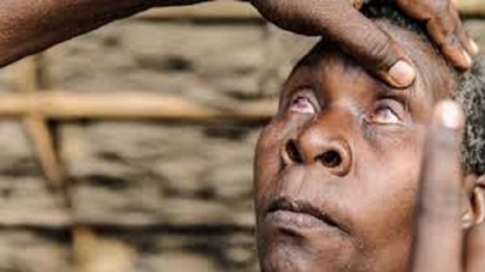 Dopo Covid arriva una malattia di origine sconosciuta: almeno 15 morte in Tanzania 