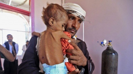 国連、「イエメンの子ども230万人が深刻な食糧不足に苦しむ」