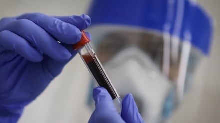  891 նոր դեպք, 19 մահ` մեկ օրում. կորոնավիրուսային հիվանդության ընթացքը Հայաստանում