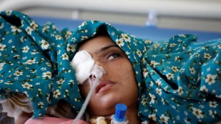 ONU: Yemen, 1milione di donne in gravidanza a rischio di malnutrizione